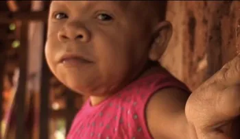 Mujer de 31 años tiene apariencia y comportamientos de una bebé