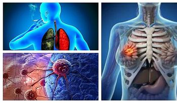 Científicos acaban de descubrir la forma correcta para tratar el cáncer 