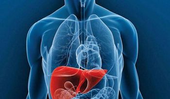  Hígado graso; una enfermedad "silenciosa" que puede derivar en cirrosis o cáncer 