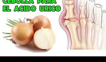 Ácido úrico eliminalo con solo 2 cebollas 