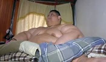 Hombre más obeso del mundo vive sus horas más críticas, dice médico que lo operó