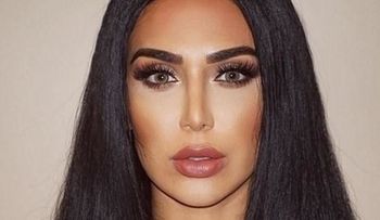 Kardashian: â??Le dijimos que tenía lesión cerebralâ?