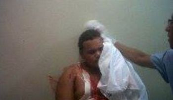 Joven denuncia golpiza le dio un policía en Montecristi
