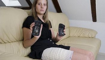 Joven sufre quemaduras al explotarle su Galaxy S3