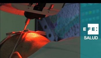 Un  robot anticalvicie (VIDEO)