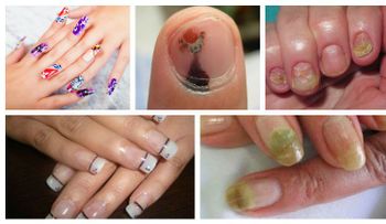 Usaba uñas acrílicas y lo que le pasó te dejara sin alientos 