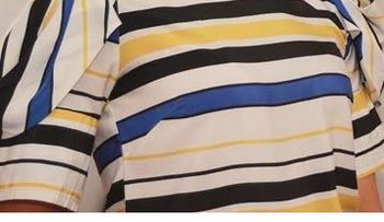 Prevención es clave para lucir bella en Semana Santa