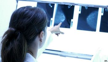 Un gen podría ayudar a proteger mujeres hispanas del cáncer de mama
