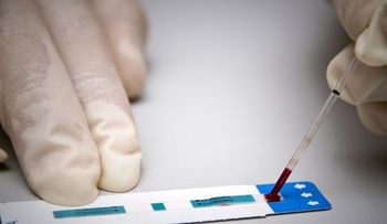 Será indemnizado con 40 mil dólares, un chileno que supo que tenía VIH 3 años después de prueba 