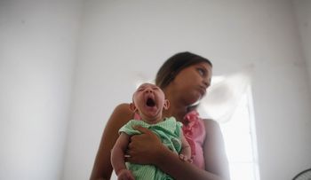 640 casos de microcefalia confirmados en Brasil