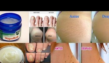 Los increíbles usos del VICKS VAPORUB que nadie te había dicho