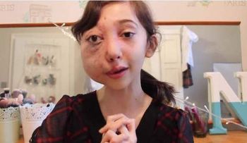 Científicos innvestigan rara enfermedad de una niña de 11 años que la hace llorar sangre: "He ido al hospital unas 600 veces"