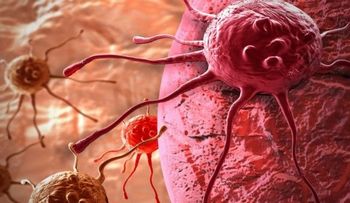 Nanomedicamentos, láser y ultrasonido: nuevas armas contra el cáncer