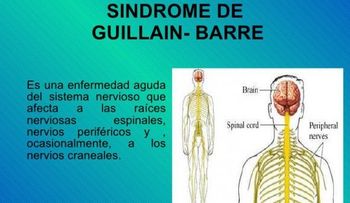 Mueren dos personas de Guillan Barré
