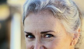 Arrugas revelan la salud de los huesos en la mujer