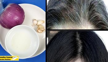 Elimina todas las canas de tu cabeza con este jugo de cebolla