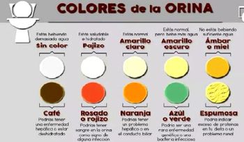Descubre la enfermedad que puede tener con el color de tu orina