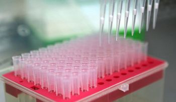 Más simple que nunca: descubren una nueva forma de diagnosticar el alzhéimer