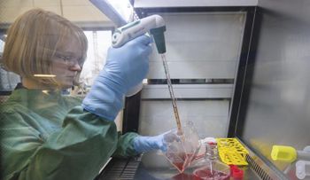 ¿La cura del cáncer? científicos logran que células cancerígenas se autodestruyan