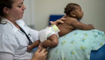 Zika: Bebés normales pueden desarrollar microcefalia el primer año