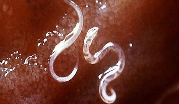 Los científicos quieren usar gusanos parásitos para tratar con éxito la esclerosis múltiple...