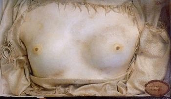 El misterio de una tecnología perdida capaz de convertir a los humanos en piedra  