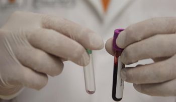 La fobia al VIH es el mayor castigo a los portadores del virus en México 