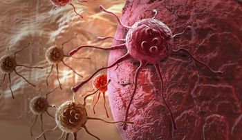 ¿Por qué hay cada vez más casos de cáncer? 3 posibles razones