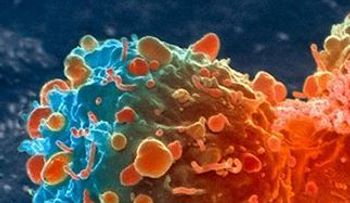 Desarrollan nueva prueba que permite detectar el cáncer en diez minutos