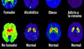 ¿Qué hace el azúcar con nuestro cerebro?