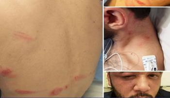 PN apresa asaltantes que raptaron y golpearon a dos jóvenes por no tener dinero en sus tarjetas
