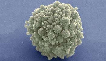 Científicos crean un microbio con la menor cantidad de genes y explican por qué es importante