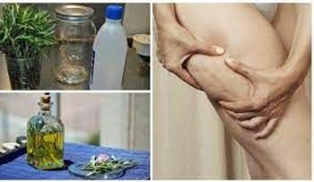 Alcohol de romero para la varices, celulitis, la gota y dolores musculares
