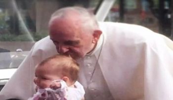 El papa Francisco besa una niña y se le reduce el tumor, según escáner (VIDEO)