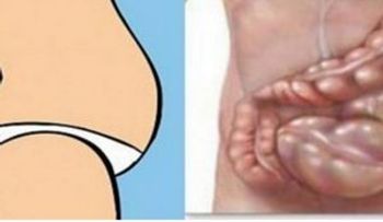 No es gordura, tu vientre está hinchado y debes limpiar tu colon con estos ingredientes: