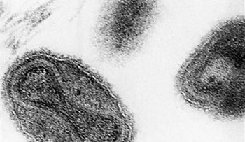 EEUU: Hallan frascos con virus de la viruela