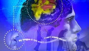 ¡Mosca! La apraxia puede avanzar a enfermedad neurodegenerativa