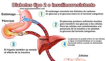 Detectan una posible diana terapéutica para tratar la diabetes tipo 2
