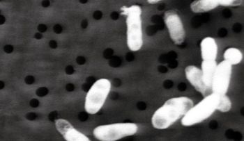"Es casi demasiado tarde para evitar que haya una superbacteria resistente a los antibióticos