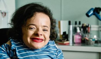 La historia de la joven con "huesos de cristal" que quiere romper con los cánones de belleza