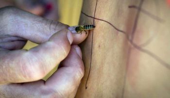 El veneno de las abejas: ¿qué propiedades curativas tiene? 