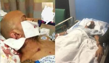 Grave un taxista dominicano Alex Acosta, apuñalado en el cuello durante atraco en el Bronx