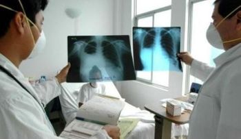  OMS plantea formula para reducir en 90 por ciento muertes por tuberculosis 
