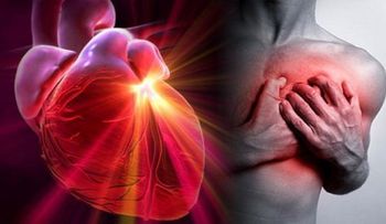 Enfermedades cardiovasculares son la 1ra causa de muerte en Venezuela
