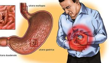 Miel, agua de arroz y avena para la gastritis