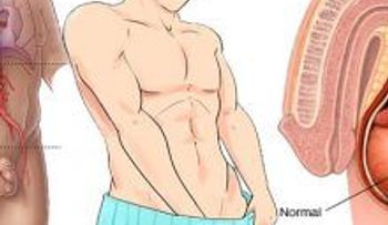 ¡Alerta de síntomas del cáncer testicular que no debes pasar por alto... Impresionante!
