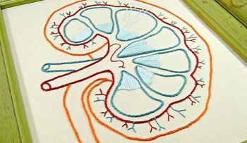 Acidosis tubular renal, ¿la â??enfermedad de modaâ??