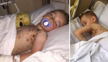 Un error de los médicos casi le cuesta la vida a este niño. ¡Todos los padres deben saberlo!
