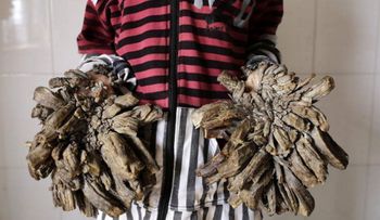 Qué es la epidermodisplasia verruciforme, el mal de los "hombres árbol"