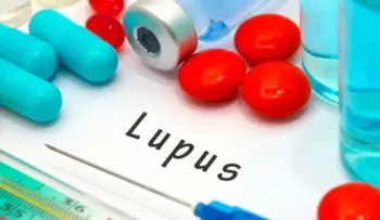 Identifican un nuevo marcador para el lupus